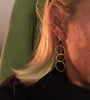 Sutton dangles